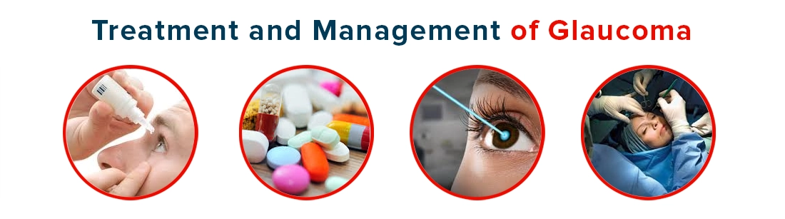 Treatment and Management of Glaucoma